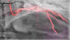 Γιώργος Μαζωνάκης - μαΖΩ Ακόμα - все още Мазо - Videoclip.bg