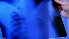 Реванш (Revansa 1978) Е01 - Videoclip.bg