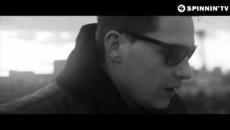 2o15 • Yellow Claw - Till It Hurts Ft. Ayden ( Lny Tnz Remix) - Videoclip.bg