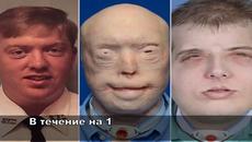 Най-шокиращите трансплантации на лице - Videoclip.bg