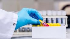 Започва масово тестване за коронавирус на българските граждани (ВИДЕО) - Videoclip.bg