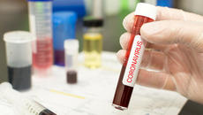 РЗИ: Болните от коронавирус в Габрово не са имали контакт - Videoclip.bg