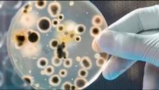 Кой е Игнац Земелвайс научаваме с Гугъл! Хигиенните порядки на Игнац Земелвайс Ignaz Semmelweis - Videoclip.bg