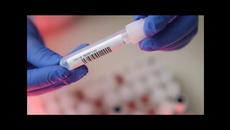 Пациентите с COVID-19 в болниците намаляват - Videoclip.bg