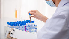 883 са новите случаи на COVID-19 коронавирус за денонощие в България - Videoclip.bg