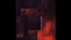 bruises | Copyright free lo-fi Hip-Hop Track Beat - Videoclip.bg